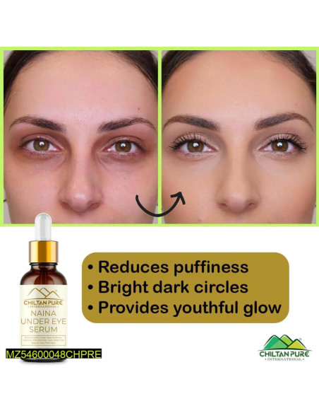 Naina under eye serum